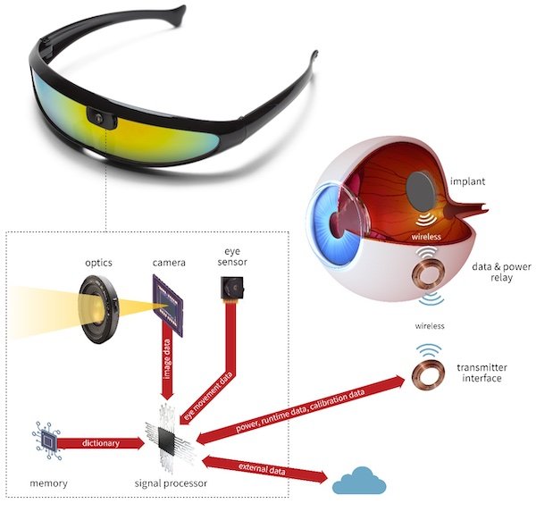 斯坦福大学的人工视网膜系统，它与其他替代品共享特征设计元素，比如带有内置摄像头的眼镜，处理能力，以及向视网膜的无线传输。